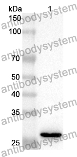 Anti-SLIT2 Polyclonal Antibody