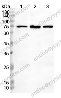 Anti-TOMM70 Polyclonal Antibody