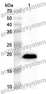 Anti-Human DDHD2 Polyclonal Antibody