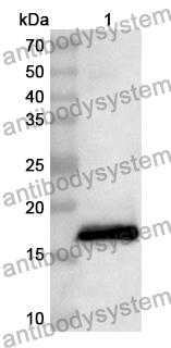 Anti-Human UFL1 Polyclonal Antibody