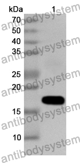 Anti-Human SORBS2 Polyclonal Antibody