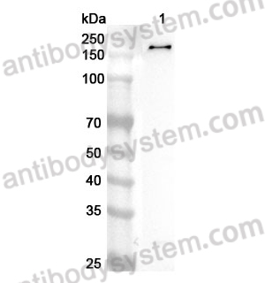 Anti-Human PHF14 Polyclonal Antibody