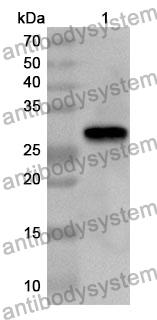 Anti-DKK1 Polyclonal Antibody