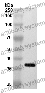 Anti-GLS Polyclonal Antibody