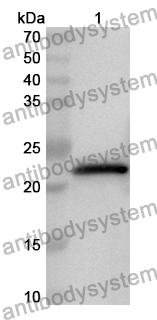 Anti-Human DIRAS1 Polyclonal Antibody