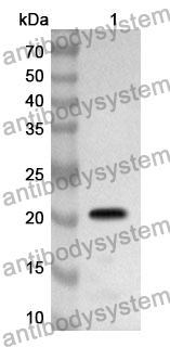 Anti-Human NDUFB6 Polyclonal Antibody