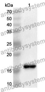 Anti-Human GABARAP Polyclonal Antibody