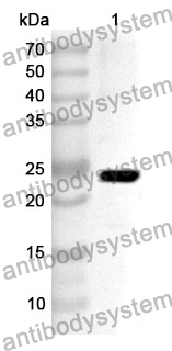 Anti-Human NDUFB8 Polyclonal Antibody