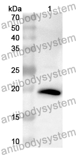 Anti-Human CSPG5 Polyclonal Antibody