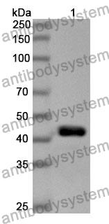 Anti-CD218b/IL18RAP Polyclonal Antibody