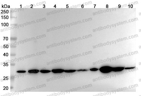 Anti-Human VAPB Polyclonal Antibody