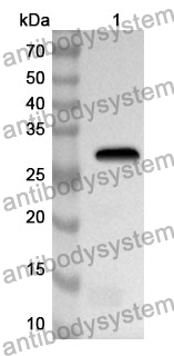 Anti-ABCB11 Polyclonal Antibody