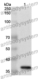 Anti-Human ATG7 Polyclonal Antibody