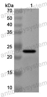 Anti-Human TRIM16 Polyclonal Antibody