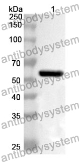 Anti-FARS2 Polyclonal Antibody