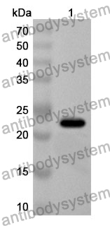 Anti-LYPLA2 Polyclonal Antibody