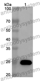 Anti-SLC34A2/NaPi2b Polyclonal Antibody