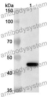 Anti-SLC34A2/ NaPi2b  Polyclonal Antibody