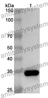 Anti-PARN Polyclonal Antibody