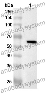 Anti-H6PD Polyclonal Antibody