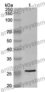 Anti-VNN1 Polyclonal Antibody