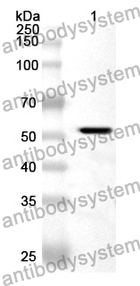 Anti-NADK Polyclonal Antibody