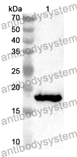 Anti-Human ACSL3 Polyclonal Antibody