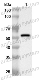 Anti-Human YEATS4 Polyclonal Antibody