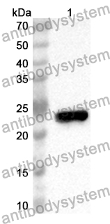 Anti-ADCY5 Polyclonal Antibody