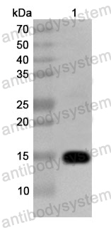 Anti-Human ATP6V1G2 Polyclonal Antibody