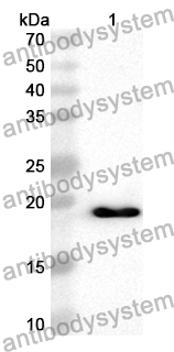 Anti-Human CDS2 Polyclonal Antibody