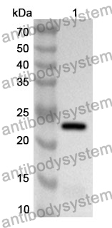 Anti-Human SNAP29 Polyclonal Antibody