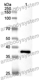 Anti-Human GGPS1 Polyclonal Antibody