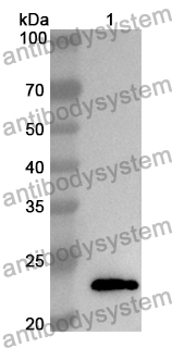 Anti-Human FGF19 Polyclonal Antibody