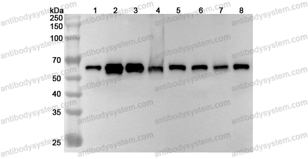 Anti-Human PTBP3 Polyclonal Antibody