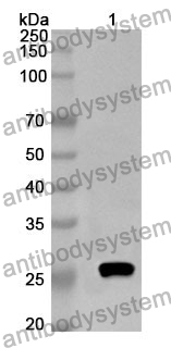 Anti-DDX58 Polyclonal Antibody