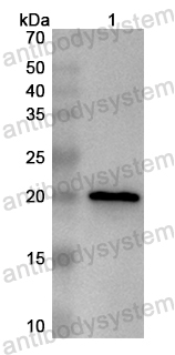 Anti-Human TTC4 Polyclonal Antibody