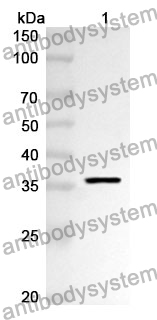 Anti-Human MLYCD Polyclonal Antibody