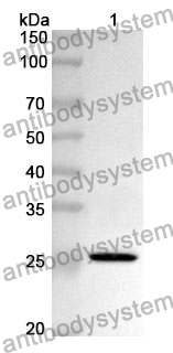 Anti-CLDN1 Polyclonal Antibody