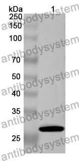 Anti-ANGPTL1 Polyclonal Antibody