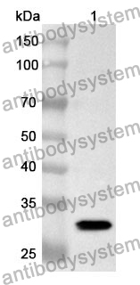 Anti-SNAI1 Polyclonal Antibody