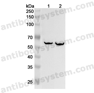 Anti-Human FTCD Polyclonal Antibody