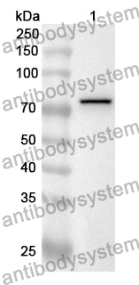 Anti-EFEMP2 Polyclonal Antibody