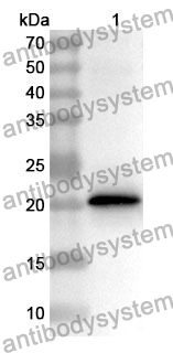 Anti-AGR2 Polyclonal Antibody