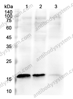 Anti-IL18BP Polyclonal Antibody