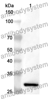 Anti-BCL10 Polyclonal Antibody