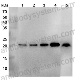 Anti-Human NDUFB10 Polyclonal Antibody