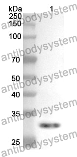 Anti-CHEK2 Polyclonal Antibody