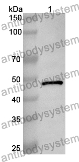 Anti-Human ACTL6A Polyclonal Antibody