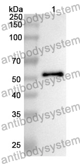 Anti-ALDH1A1 Polyclonal Antibody